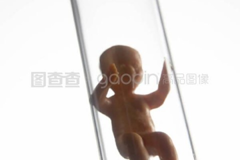 http://yantai.vdtfzz.com/post/197.html|烟台试管助孕